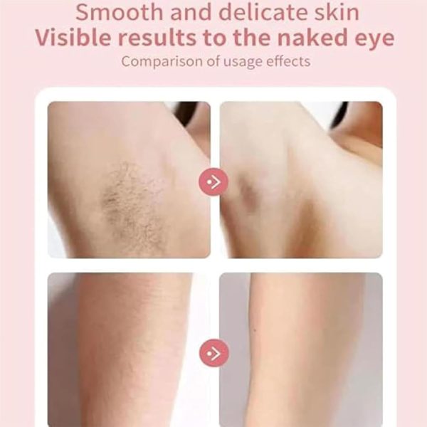 Epibella Epilator, Epibella Epilator Facial Hair Removal, Ep... - Image 3