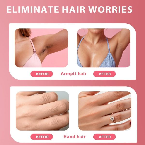 Silklip Hair Removal Kit, Liorabeauty Glide & Go Hair Remova... - Image 2