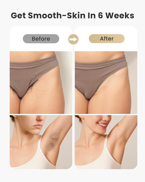 LAORICI Laser Hair Removal, IPL Hair Removal with Ice-Coolin... - Image 5