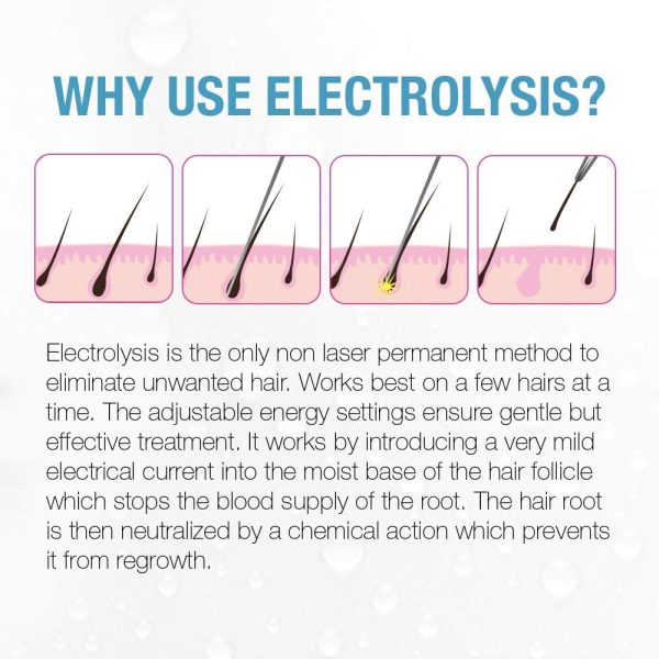 Clean + Easy Non-Laser Personal Electrolysis for Face and Bo... - Image 8