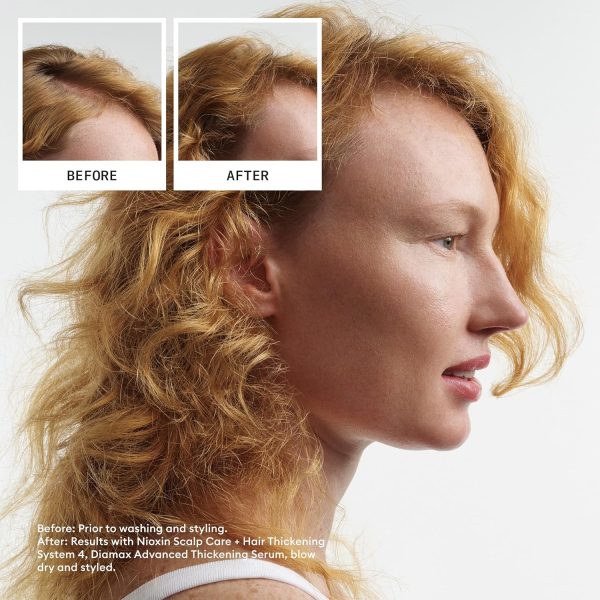 Nioxin Scalp + Hair Thickening System Kits | For Natural, Co... - Image 7